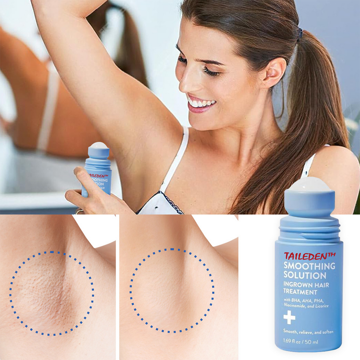 TAILEDEN™ Smoothing Solution Ingrown Hair Treatment: Glide Your Way to Silky-Smooth, Bump-Free Skin