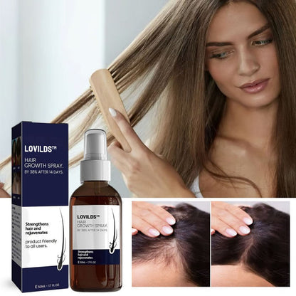 🔥(Last Day SAVE 60% OFF)LOVILDS Natural Hair Regrowth Spray